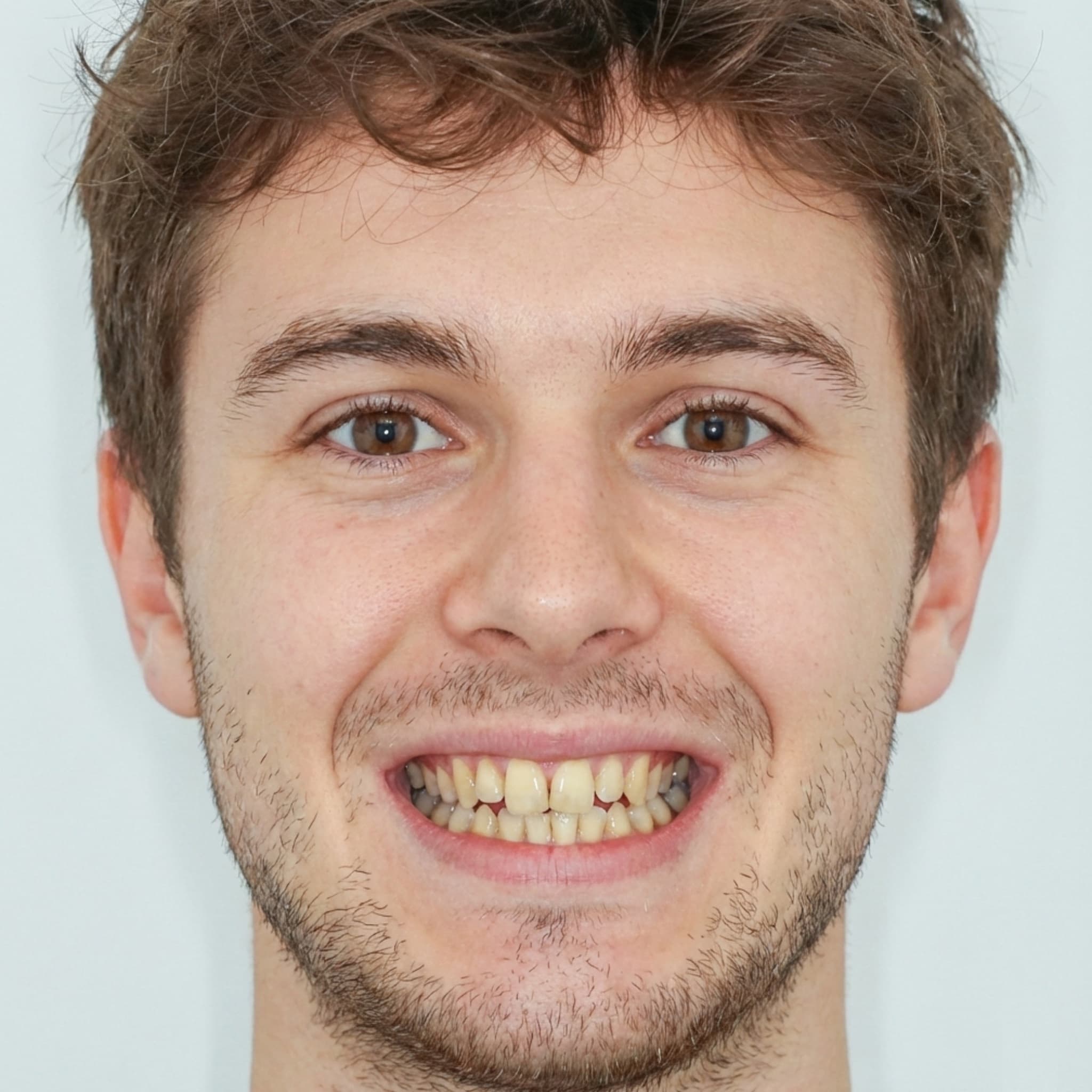Cosmetic makeover original smile input